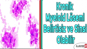 Kronik myeloid lösemi belirtisiz ve sinsi olabilir