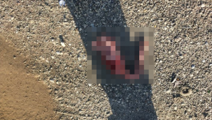 Gaziantep'te kemik kalıntıları korkuttu