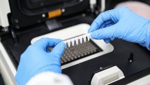 Rus bir kadında 18 koronavirüs mutasyonu bulundu