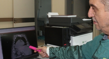 Dünyada İlk Kez Görüldü: 'Giresun Sendromu' Bilim Dünyasını Şaşırttı